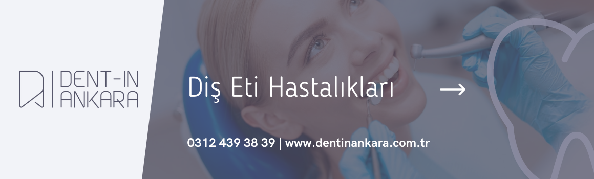 Gum Treatment Ankara , 2021 Laser Gum Treatment Prices Ankara , Dentin Ankara , Gum Diseases Specialist Ankara , Dentin Ankara