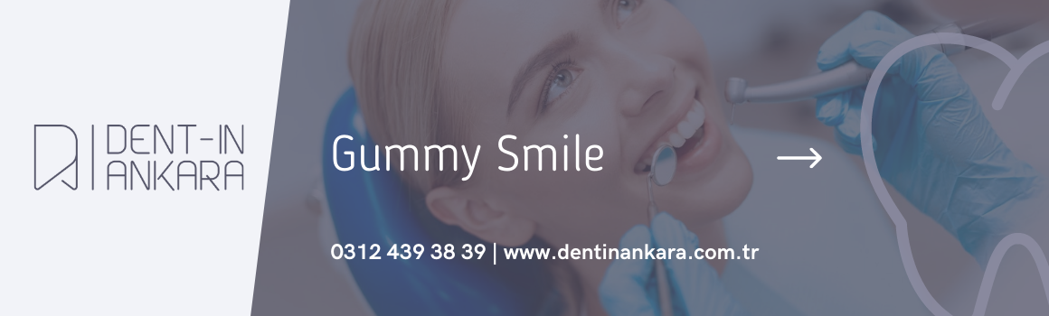 Gummy Smile Treatment , 2021 Gummy Smile Treatment Prices Ankara , Gummy Smile Price , Dentin Oral and Dental Health Center