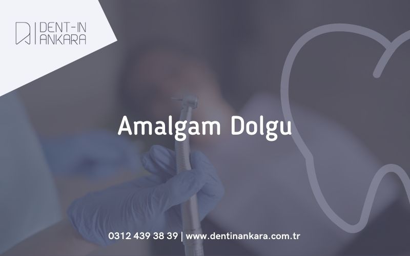 Amalgam Dolgu