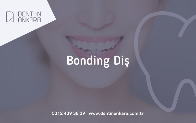 Bonding Diş