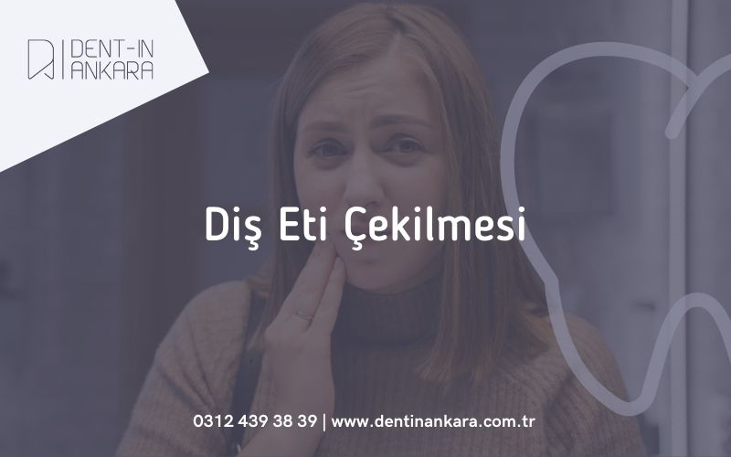 Diş Eti Çekilmesi