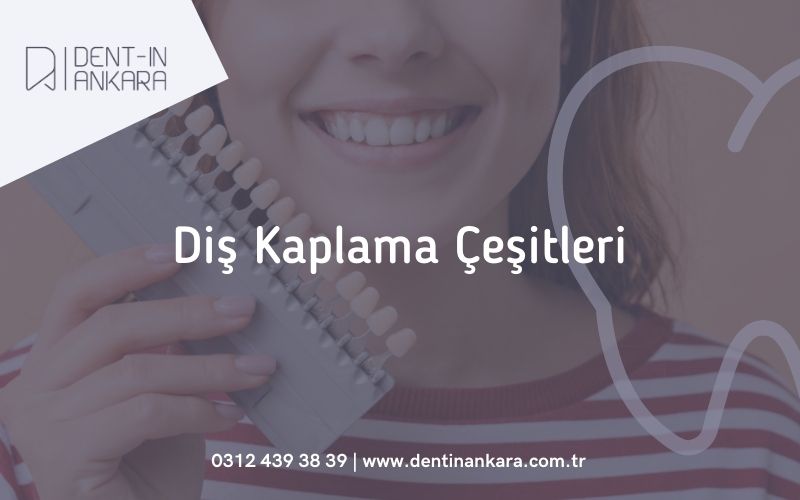 Diş Kaplama Çeşitleri