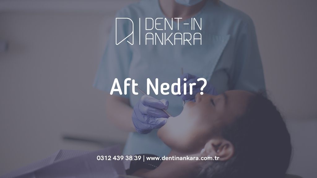 Aft Nedir