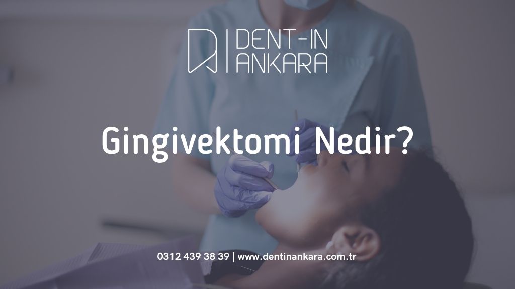 Gingivektomi Nedir