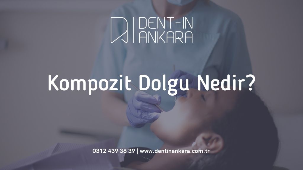 Kompozit Dolgu Nedir