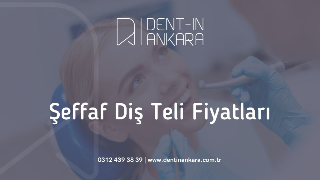 Şeffaf Diş Teli Fiyatları