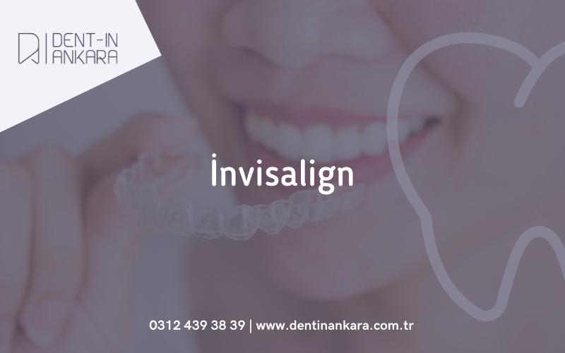 İnvisalign